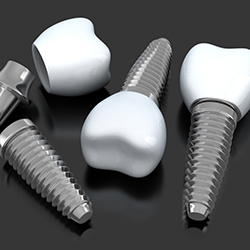 Animation of of implant supported dental crowns