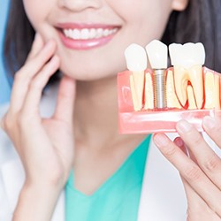 a dentist holding a plastic model of dental implants
