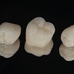 three dental crowns in Groveport against black background 