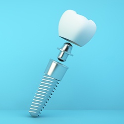 A single tooth dental implant that shows each unique part