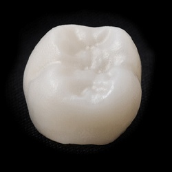 A ceramic dental crown 
